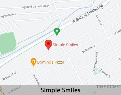 Map image for What Can I Do to Improve My Smile in Johnson City, TN