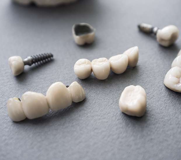 Johnson City The Difference Between Dental Implants and Mini Dental Implants